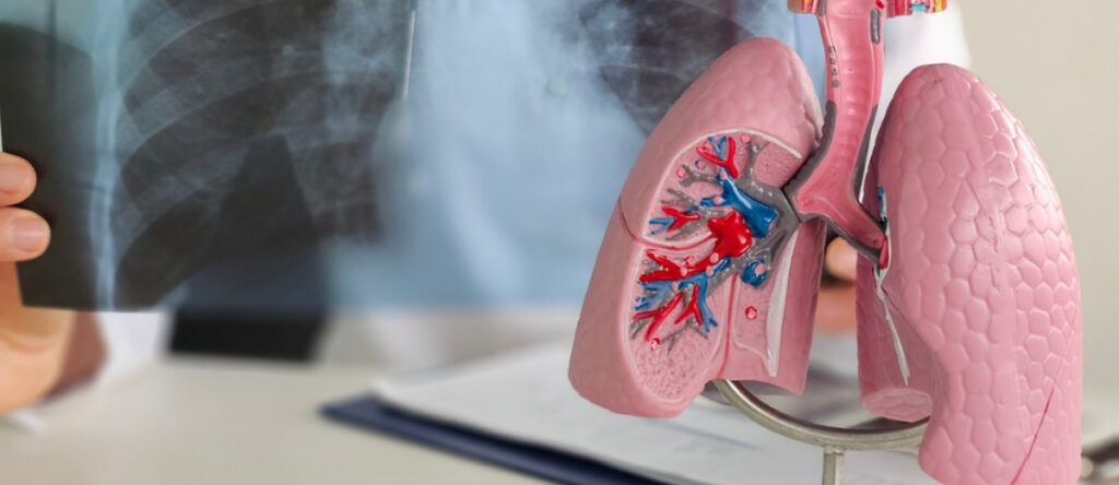 bpco santagostino cernusco