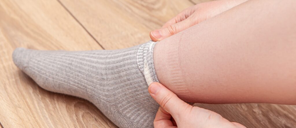 gambe gonfie santagostino cernusco