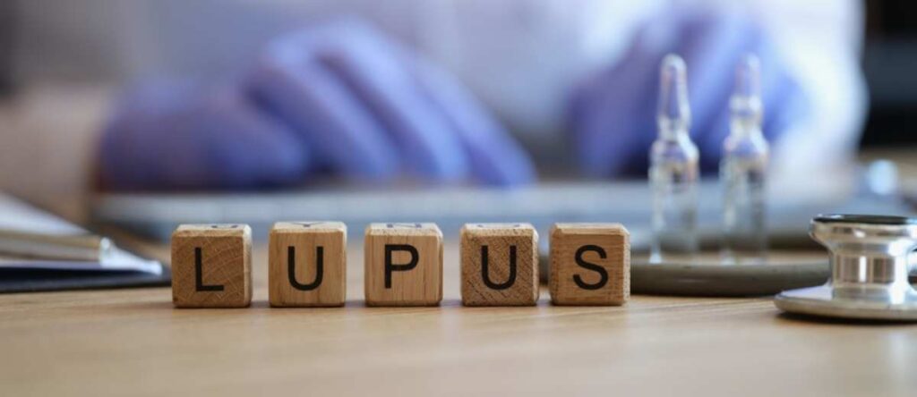 lupus cernusco