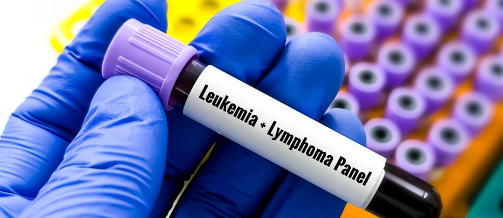 leucemia linfatica cronica santagostino cernusco